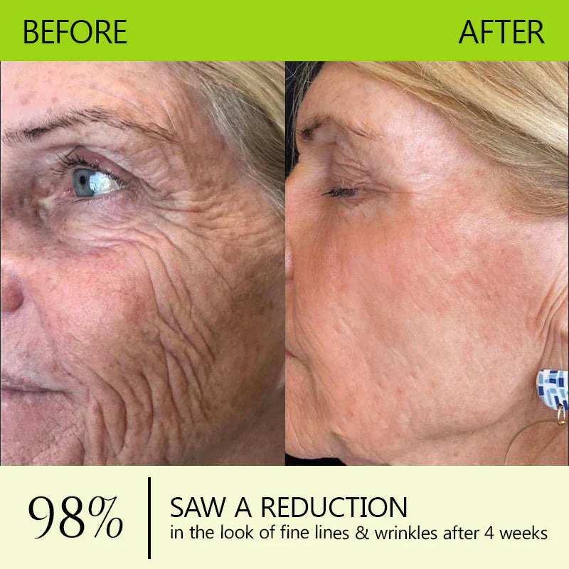 𝑶𝒇𝒇𝒊𝒄𝒊𝒂𝒍 𝑺𝒕𝒐𝒓𝒆👍| Regain youthful skin nown 💫STDEI® BOTOX & VITA A RETINOL SHOT Wrinkle Lift Tightening Cream