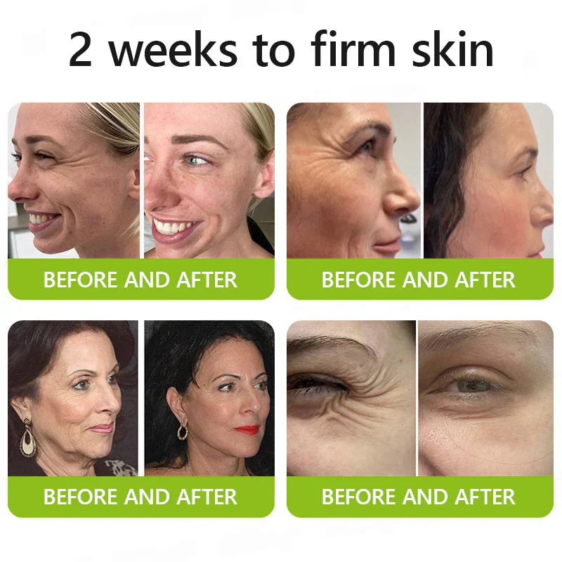 𝑶𝒇𝒇𝒊𝒄𝒊𝒂𝒍 𝑺𝒕𝒐𝒓𝒆👍| Regain youthful skin nown 💫STDEI® BOTOX & VITA A RETINOL SHOT Wrinkle Lift Tightening Cream